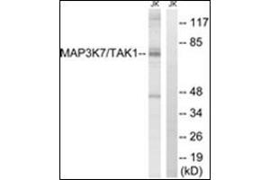 Western blot analysis of extracts from Jurkat cells, treated with heat shock, using MAP3K7 Antibody. (MAP3K7 抗体  (Internal Region))