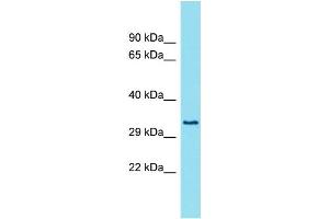 Host: Rabbit Target Name: FAM26E Sample Type: Fetal Lung lysates Antibody Dilution: 1. (FAM26E 抗体  (Middle Region))