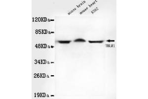 Western blot detection of TBLR1 in Mouse brain,Mouse heart and K562 cell lysates using TBLR1 mouse mAb (1:1000 diluted). (TBL1XR1 抗体)