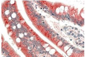 AP31058PU-N C18orf8 antibody staining of paraffin embedded Human Small Intestine at 5 µg/ml. (C18orf8 抗体  (Internal Region))
