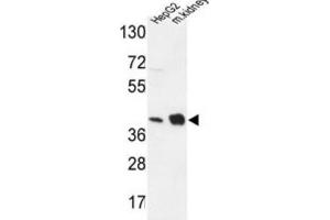 Western Blotting (WB) image for anti-NADH Dehydrogenase (Ubiquinone) 1 alpha Subcomplex, 10, 42kDa (NDUFA10) antibody (ABIN3004309) (NDUFA10 抗体)