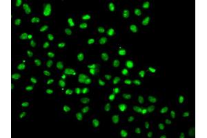 Immunofluorescence analysis of MCF-7 cells using HMG20A antibody (ABIN5974388). (HMG20A 抗体)