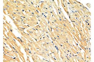 ABIN6263592 and ABIN6279797 at 1/100 staining Rat heart tissue by IHC-P.