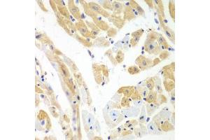 Immunohistochemistry of paraffin-embedded mouse heart using PCBP2 antibody. (PCBP2 抗体)