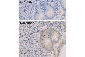 Immunohistochemistry (IHC) image for anti-Receptor tyrosine-protein kinase erbB-2 (ErbB2/Her2) (C-Term) antibody (ABIN6254225) (ErbB2/Her2 抗体  (C-Term))