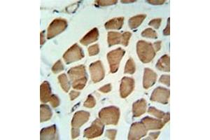 Immunohistochemistry analysis in formalin fixed and paraffin embedded skeletal muscle reacted with PDK2 Antibody  followed by peroxidase conjugation of the secondary antibody and DAB staining. (PDK2 抗体)