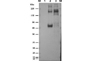 Western blot: anti-Spikeprotein M: Marker 1: (ABIN7538787) VLP_SARS-CoV-2 (M+E+N) 2: SARS-CoV-2 spikeprotein (Sino Biologicals 40589-V08B1) 3: (ABIN7538786) VLP_SARS-CoV-2 (S+M+E+N) 1°Antibody: C-0005-50UL Mouse anti-SARS-CoV-2 spike serum 1:5000 2°Antibody: Goat-anti-mouse-HRP