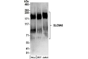 Western Blotting (WB) image for anti-Solute Carrier Family 9 (Sodium/hydrogen Exchanger), Member 6 (SLC9A6) (AA 619-669) antibody (ABIN7450743)