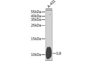 Western blot analysis of extracts of A-431 cells using IL8 Polyclonal Antibody at dilution of 1:1000. (IL-8 抗体)