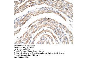 Immunohistochemistry (IHC) image for anti-Cleavage and Polyadenylation Specific Factor 6, 68kDa (CPSF6) (Middle Region) antibody (ABIN2779018)