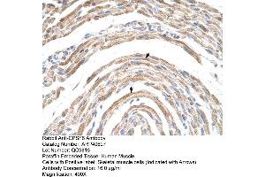 Rabbit Anti-CPSF6 Antibody  Paraffin Embedded Tissue: Human Muscle Cellular Data: Skeletal muscle cells Antibody Concentration: 16. (CPSF6 抗体  (Middle Region))