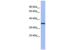 Image no. 1 for anti-Wingless-Type MMTV Integration Site Family, Member 4 (WNT4) (AA 143-192) antibody (ABIN6742254) (WNT4 抗体  (AA 143-192))