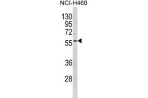 Western Blotting (WB) image for anti-Potassium Inwardly-Rectifying Channel, Subfamily J, Member 2 (KCNJ2) antibody (ABIN3002884) (KCNJ2 抗体)