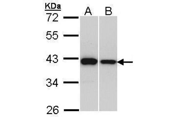 RAD51 抗体  (Center)