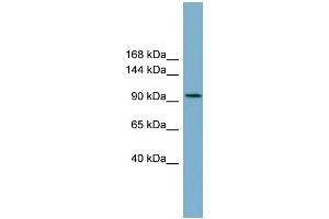 WB Suggested Anti-SLC12A3 Antibody Titration:  0. (SLC12A3 抗体  (Middle Region))