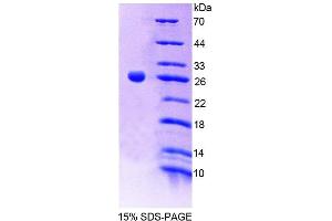 SDS-PAGE analysis of Mouse CNTN2 Protein. (CNTN2 蛋白)