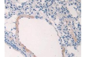 Immunohistochemistry (IHC) image for anti-Collagen, Type II, alpha 1 (COL2A1) (AA 1307-1383) antibody (ABIN7438682)
