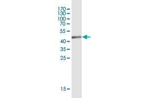 Western Blot detection against Immunogen (45. (EFCAB11 抗体  (AA 1-163))