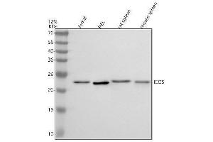 Western blot analysis of ICOS using anti-ICOS antibody (ABIN7605213).