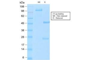 SDS-PAGE analysis of purified, BSA-free recombinant MUC16 antibody (clone OCA125/2349R) as confirmation of integrity and purity. (MUC16 抗体)