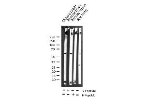 Western blot analysis of Phospho-Smad1 (Ser465) expression in various lysates (SMAD1 抗体  (pSer465))