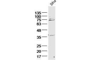 Siha lysates probed with Cytokeratin 2e Polyclonal Antibody, unconjugated  at 1:300 overnight at 4°C followed by a conjugated secondary antibody for 60 minutes at 37°C. (Keratin 2 抗体  (AA 251-350))