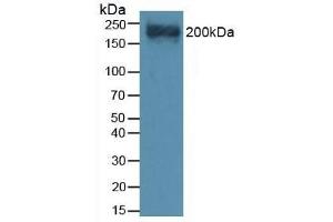 Detection of VCAN in Mouse Heart Tissue using Polyclonal Antibody to Versican (VCAN) (Versican 抗体  (AA 3058-3299))