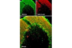 Multiplex staining of TRPC6 and TRPC3 in rat cerebellumImmunohistochemical staining of rat cerebellum frozen section using Guinea pig Anti-TRPC6 Antibody (ABIN7043826, ABIN7045362 and ABIN7045363) and rabbit Anti-TRPC3-ATTO Fluor-594 Antibody (ABIN7043819).