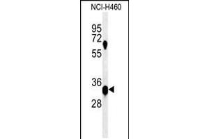 Western blot analysis of KCTD1 Antibody in NCI-H460 cell line lysates (35ug/lane) (KCTD1 抗体  (C-Term))