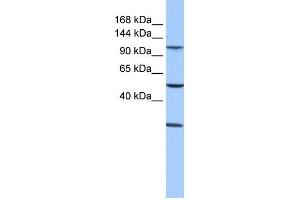 WB Suggested Anti-STAG3 Antibody Titration: 0. (STAG3 抗体  (Middle Region))