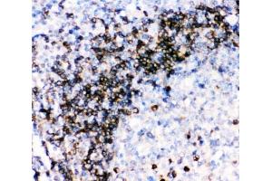 IHC-P: CD79a antibody testing of human tonsil tissue (CD79a 抗体  (AA 121-226))