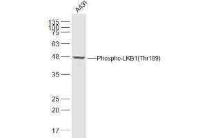 A431 lysates probed with LKB1(Thr189) Polyclonal Antibody, Unconjugated  at 1:500 dilution and 4˚C overnight incubation. (LKB1 抗体  (pThr189))
