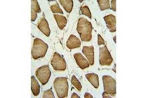 Formalin-fixed and paraffin-embedded human Skeletal muscle reacted with CAV3 Antibody (N-term), which was peroxidase-conjugated to the secondary antibody, followed by DAB staining. (Caveolin 3 抗体  (N-Term))