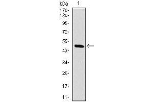 Western blot analysis using RAF1 mAb against human RAF1 (AA: 198-407) recombinant protein. (RAF1 抗体)