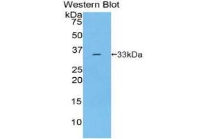 Western blot analysis of recombinant Human ROR1. (ROR1 抗体  (AA 540-795))