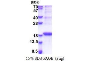 SDS-PAGE (SDS) image for Limb-Bud and Heart (LBH) (AA 1-105) protein (His tag) (ABIN6387313)