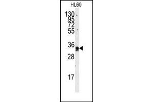 Image no. 1 for anti-Exosome Component 8 (EXOSC8) (C-Term) antibody (ABIN357948) (EXOSC8 抗体  (C-Term))