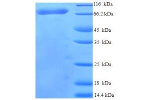 SDS-PAGE (SDS) image for Usher Syndrome 1C (Autosomal Recessive, Severe) (USH1C) (AA 1-533) protein (His-SUMO Tag) (ABIN5712005)