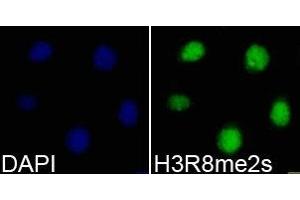Immunofluorescence analysis of 293T cell using H3R8me2s antibody. (Histone 3 抗体  (H3R8me2s))