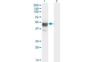 Western Blot analysis of MAGEB1 expression in transfected 293T cell line by MAGEB1 monoclonal antibody (M09), clone 3C1. (MAGEB1 抗体  (AA 86-195))