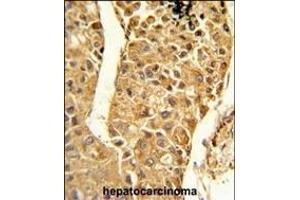 Immunohistochemistry (Paraffin-embedded Sections) (IHC (p)) image for anti-Cytochrome P450, Family 2, Subfamily C, Polypeptide 18 (CYP2C18) (AA 448-478), (C-Term) antibody (ABIN652672)