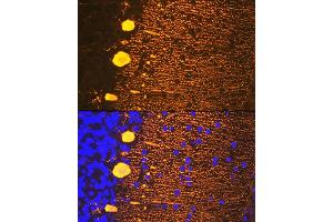 anti-Calbindin (CALB1) antibody
