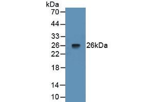 Detection of Recombinant PTX3, Rat using Monoclonal Antibody to Pentraxin 3, Long (PTX3) (PTX3 抗体  (AA 195-381))