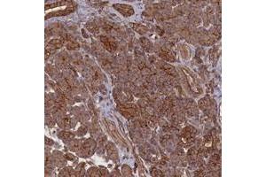 Immunohistochemical staining of human pancreas with ZNF646 polyclonal antibody  shows strong cytoplasmic and membranous positivity in exocrine glandular cells at 1:500-1:1000 dilution. (ZNF646 抗体)