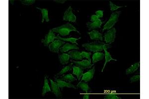 Immunofluorescence of monoclonal antibody to CDK4 on HeLa cell. (CDK4 抗体  (AA 211-303))