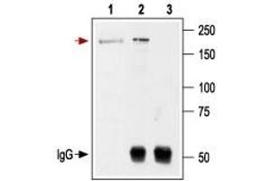 Immunoprecipitation (IP) image for anti-Glutamate Receptor, Ionotropic, N-Methyl D-Aspartate 2B (GRIN2B) (Extracellular) antibody (ABIN7043230)