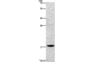 Western blot analysis of Mouse stomach tissue, using GRP Polyclonal Antibody at dilution of 1:1000 (Gastrin-Releasing Peptide 抗体)