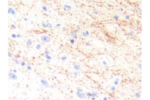 Detection of IL13 in Human Brain Tissue using Polyclonal Antibody to Interleukin 13 (IL13) (IL-13 抗体  (AA 25-146))