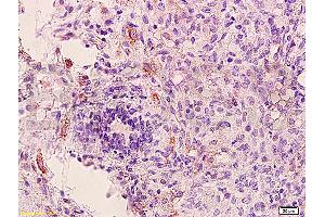 Immunohistochemistry (IHC) image for anti-Fms-Related tyrosine Kinase 1 (VEGFR1) (FLT1) (AA 1162-1260) antibody (ABIN725795)