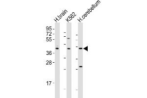 Western Blot at 1:2000 dilution Lane 1: human brain lysates Lane 2: K562 whole cell lysates Lane 3: human cerebellum lysates Lysates/proteins at 20 ug per lane. (Dopamine d2 Receptor 抗体  (C-Term))